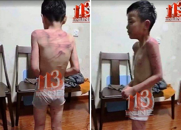 Công an xác minh thông tin cháu bé bị bạo hành ở Triệu Sơn Thanh Hóa